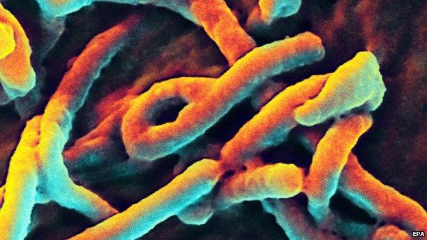 Electron micrograph image of Ebola virus