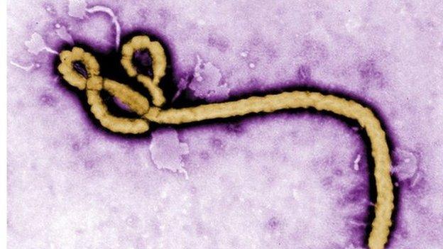 Ebola virus