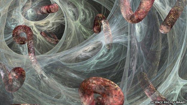 A computer generated image of the Ebola virus