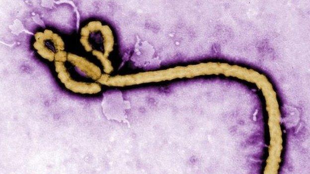 Ebola virus