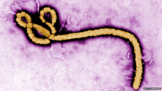 Ebola virus virion