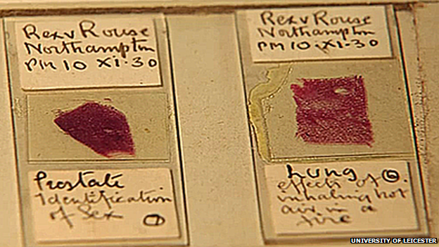 Slides containing tissue samples from Alfred Rouse's victim