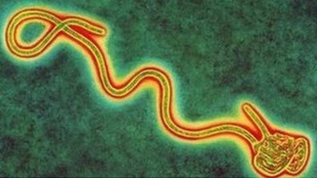 Coloured transmission electron micro graph of a single Ebola virus, the cause of Ebola fever