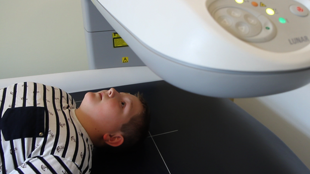 Boy lying down under a scanner