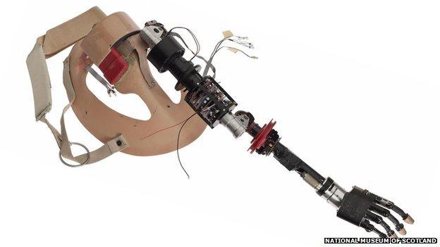 Bionic arm