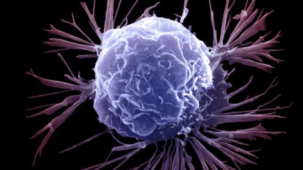 Breast cancer cell