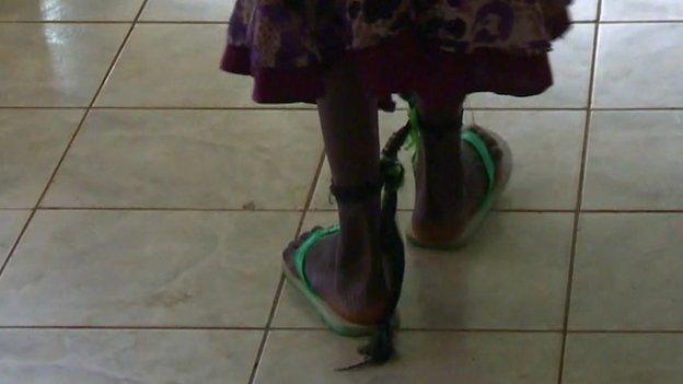 A mentally ill patient in Juba, South Sudan (October 2014)