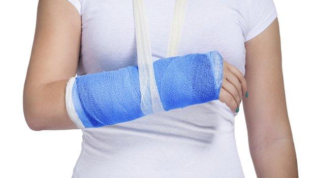 Women with broken arm