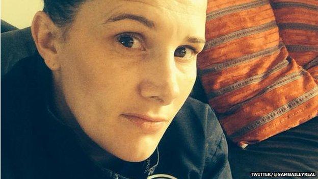 Sam Bailey says the illness Bell's Palsy has left her feeling "numb".