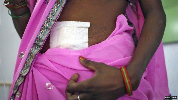 A woman, who underwent sterilization surgery at a government mass sterilisation "camp", walks to sit in a hospital bed at a district hospital in Bilaspur, in the eastern Indian state of Chhattisgarh, November 13, 2014