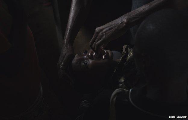 A child receives a polio vaccine