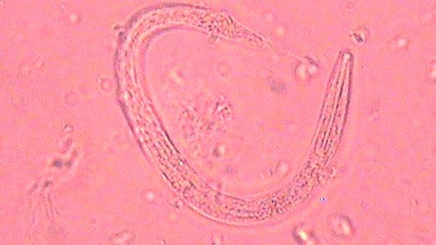 Parasitic worm