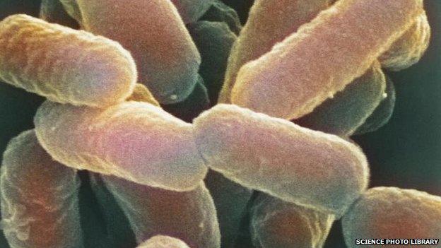 Coloured scanning electron micrograph (SEM) of Escherichia coli 0157:H7