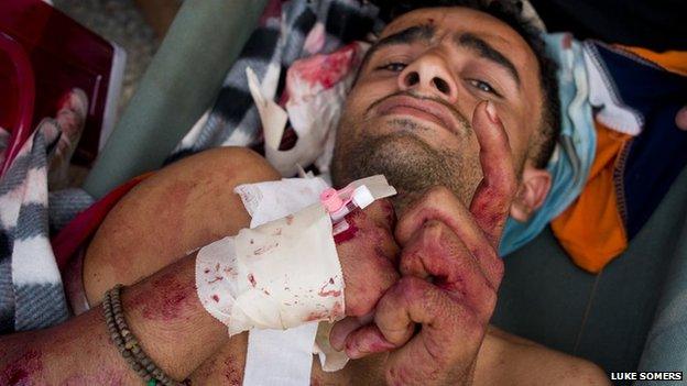 Bloodied man at a makeshift hospital in Sanaa on 18 September 2011. The man was wounded when government security forces and plainclothes gunmen opened fire on a demonstration.