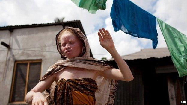 A Tanzanian albino hangs clothes to dry in front of her home in Dar es Salaam on 3 November 2010