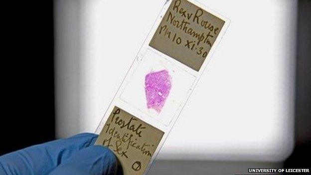 Slide containing tissue sample from Alfred Rouse's victim