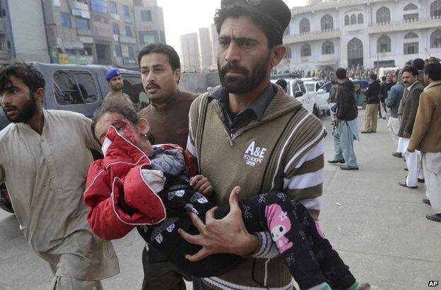 A Pakistani girl, who was injured in a Taliban attack in a school, is rushed to a hospital in Peshawar, Pakistan, 16 December 2014