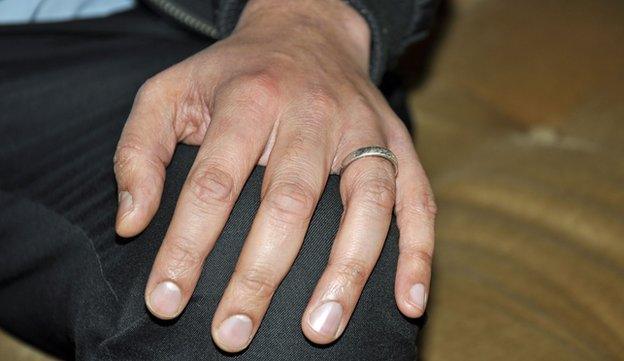 Tauseef's hand with his wedding ring