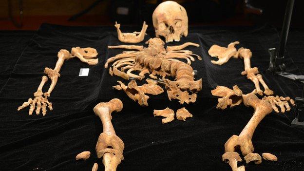 Richard III bones