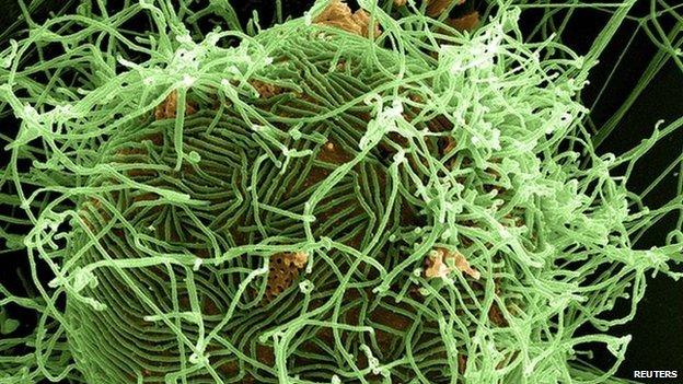 Ebola virus particles in green, budding from a chronically infected cell