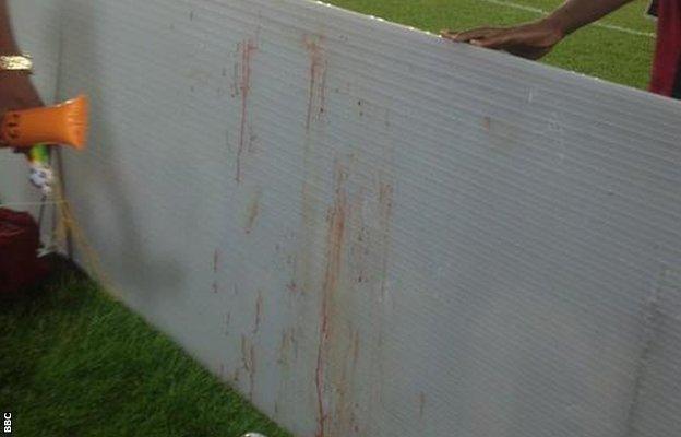 A blood-stained advertising board next to the pitch