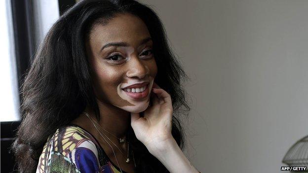 Winnie Harlow smiling
