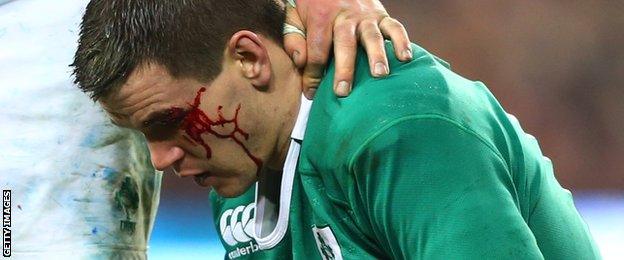 Johnny Sexton sustained a facial cut