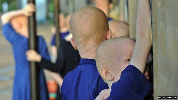 Albino boys in Tanzania