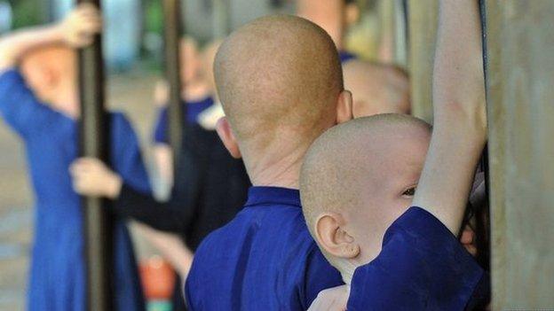 Albino boys in Tanzania