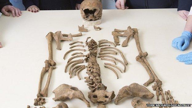 Medieval skeletons in York