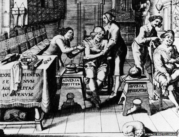 17th century barber surgeons