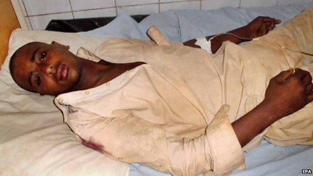 A labourer who was injured in the attack receives medical treatment at a local hospital in Turbat, Balochistan province (11 April 2015)