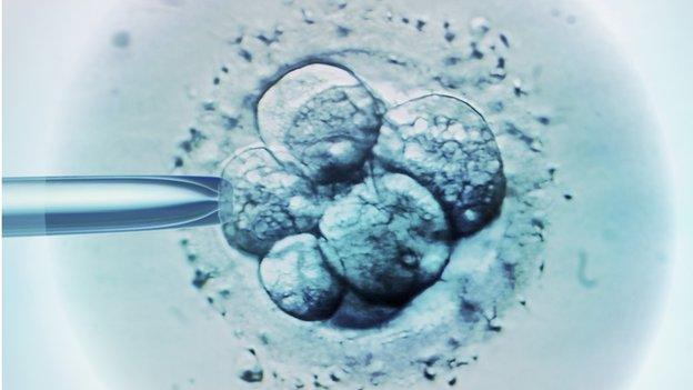 Embryo selection for IVF