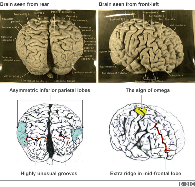 Diagrams and pictures of Einstein's brain