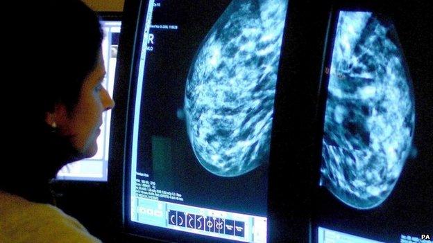 A consultant analyzing a mammogram