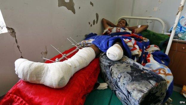 A man receives treatment at a hospital in Sanaa, Yemen, after Saudi-led coalition air strikes (21 April 2015)