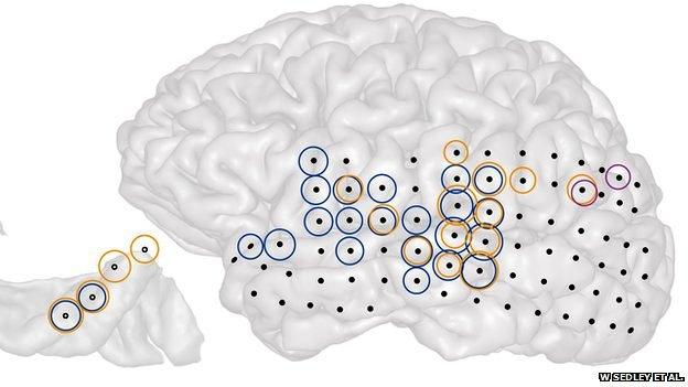 brain recordings illustration