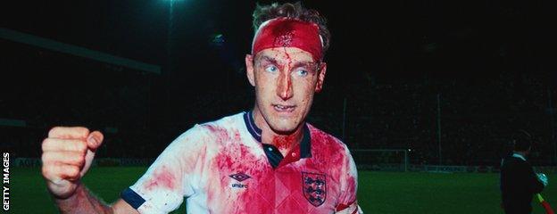 Terry Butcher