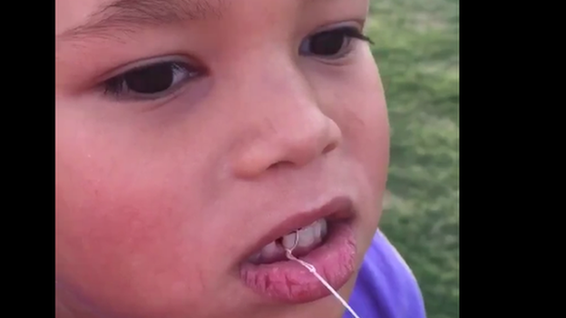 Ellie, aged 5, waits patiently with the floss attached to her tooth on one end and the javelin at the other