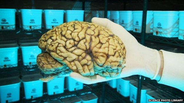 Human brain stored at research lab