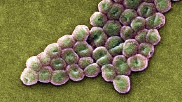 The Acinetobacter baumannii superbug