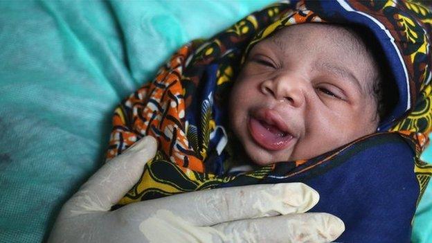 Baby recently delivered (not in a power cut hospital in Accra)