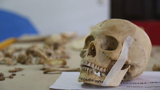 A skull in the Institute of Legal Medicine in San Salvador