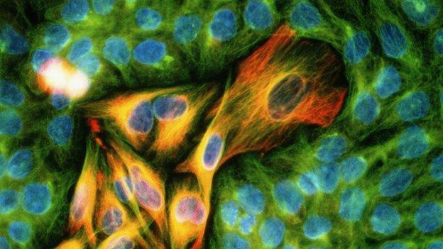 melanoma cell