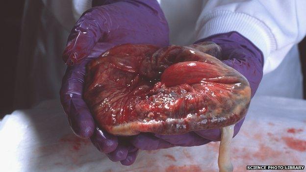 A human placenta