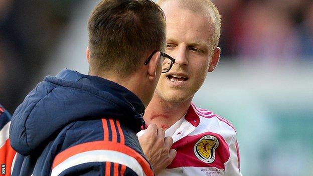 Steven Naismith shows the cuts he suffered against Qatar