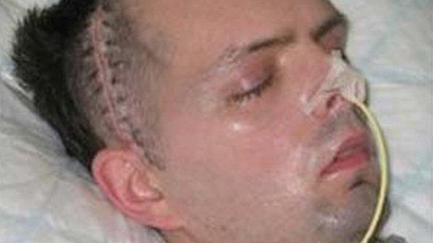 Londonderry civil servant Paul McCauley after he was beaten up in a sectarian attack in July 2006