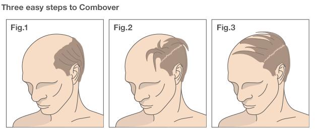 Three easy steps to combover