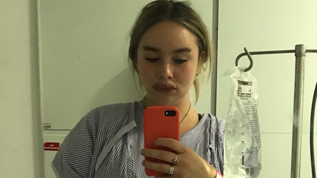 Chloe Dickson looks down at her phone while taking a selfie in a mirror. She is attached to a drip and is wearing a blue and white stripped hospital gown. The right side of her lower face is swollen following an anaphylactic shock. She stands against a plain white hospital wall with her drip and stand positioned to the left of her.