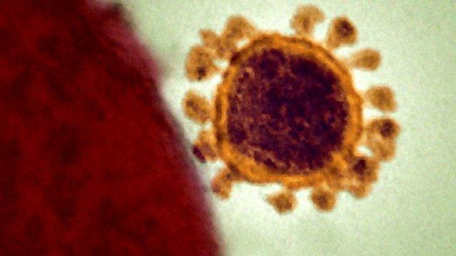 A MERS virus